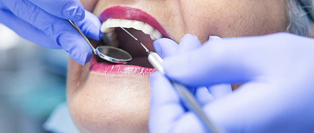 Best Emergency Dentist for Lost Fillings or Crowns in Bedford, IA